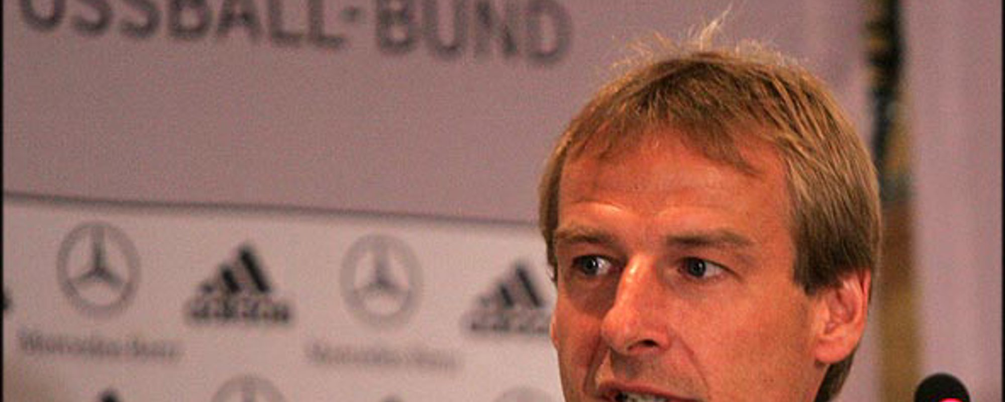 Employee Experience lessons from Jurgen Klinsmann